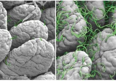 Segmented filamentous bacteria artificially colored in green attach to the intestinal wall of a mouse